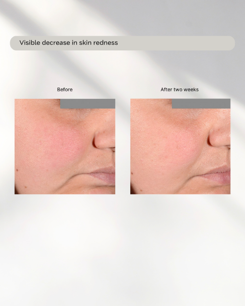 The Innovator by Modern Age Skin