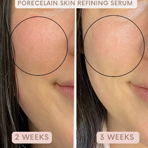 Porecelain™ Skin Refining Serum by Auvê® Beauty
